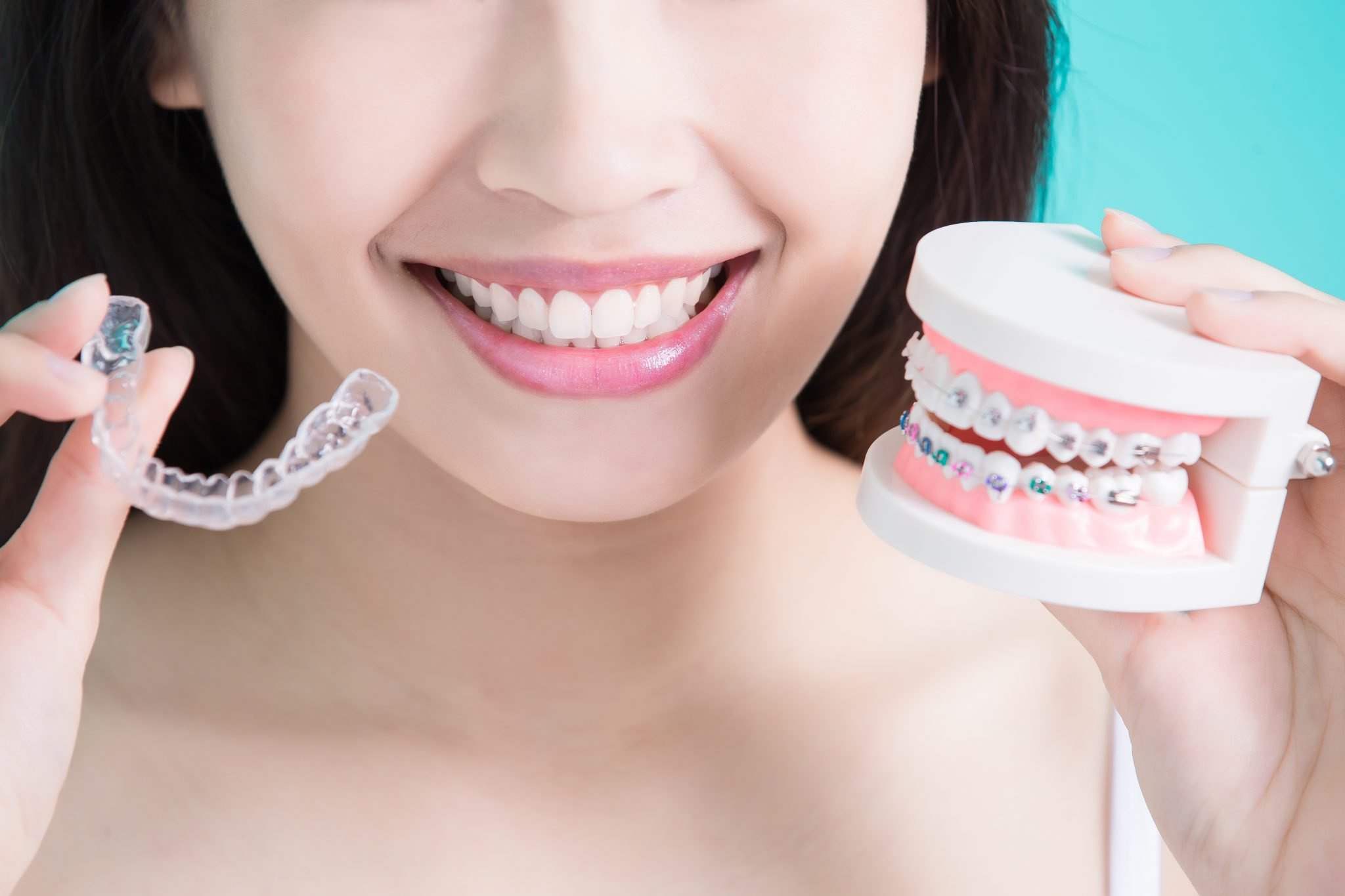 Invisalign Braces Retainers - Kaizen Dental Richmond