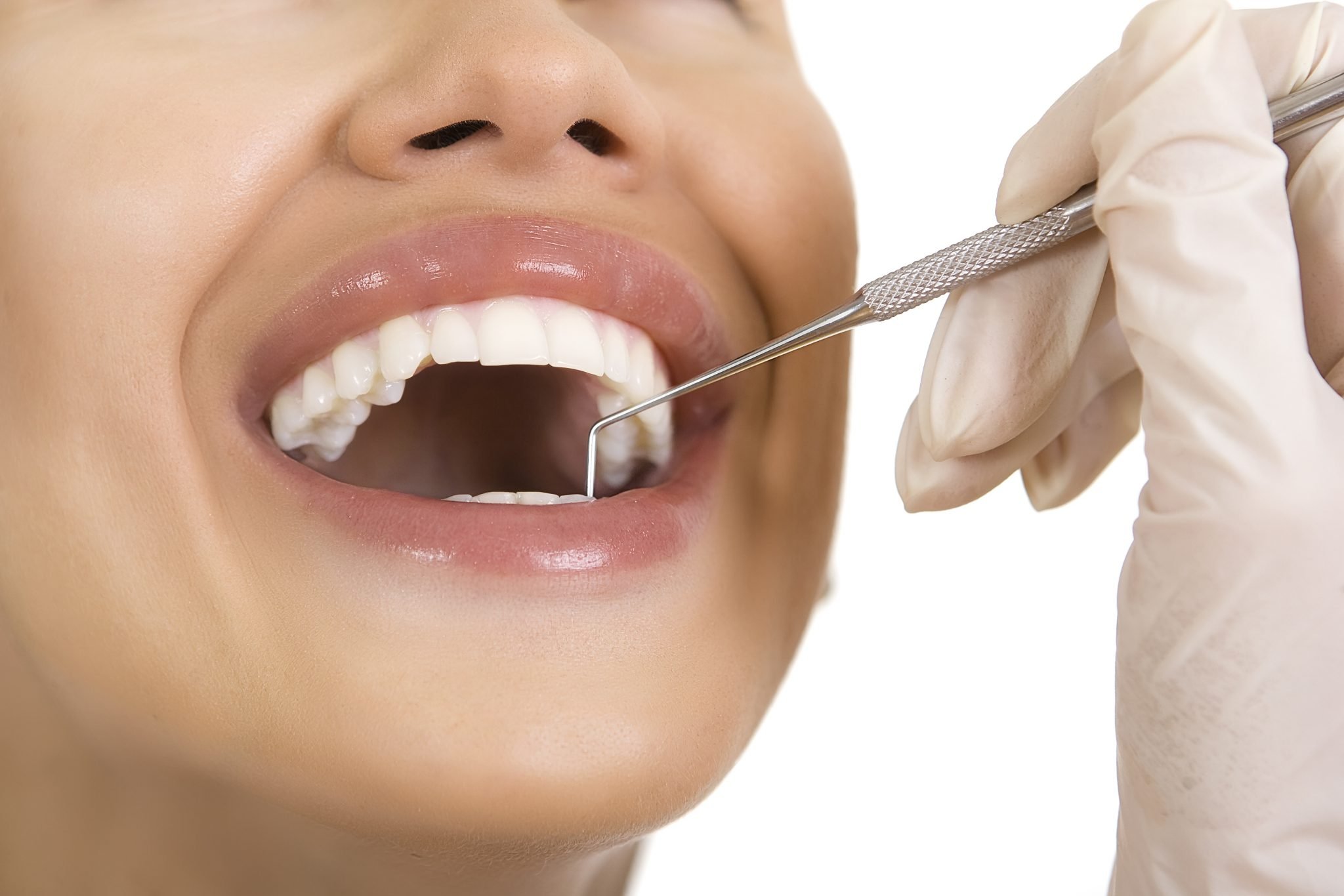 Teeth Whitening Kits - Bleach Treatments | Kaizen Dental